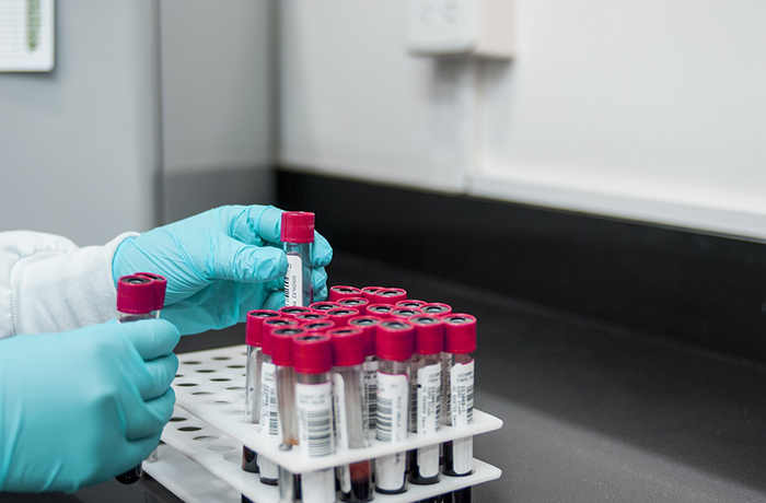 Blood samples are organized in a lab