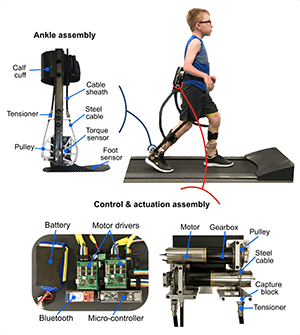 Robotic Exoskeletion Therapy
